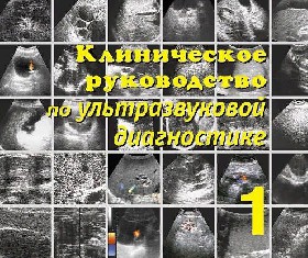 Клиническое руководство по ультразвуковой диагностике митьков в.в. в 5 томах